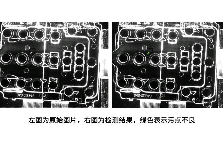 Scratch and stain detection of mobile phone structural parts